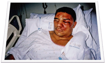 Image of police brutality cop abuse victim on McDermott and McDermott criminal defense attorneys